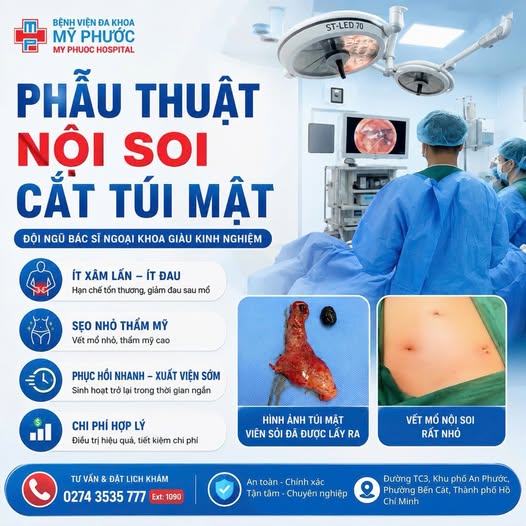 Đau thượng vị kéo dài, uống thuốc dạ dày mãi không khỏi? Cẩn thận nguyên nhân có thể là sỏi túi mật.