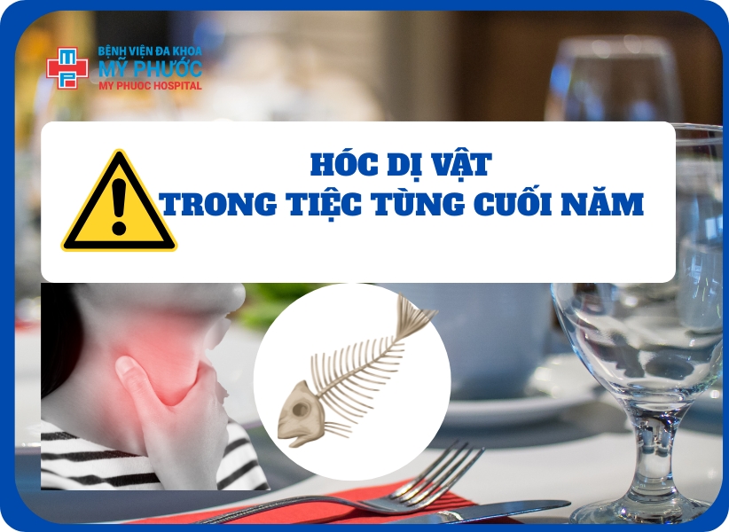 Cảnh báo hóc dị vật trong tiệc tùng cuối năm – Nguy cơ biến chứng nếu xử trí muộn
